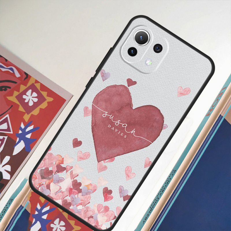 مخصص البولكا القلب ارتفع الذهب - مراجعة Monogram Custom Case وسعره